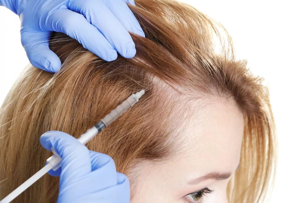 Инъекции головы. Hair treatment мезотерапия. Мезо волосистой части головы. PRP плазмотерапия для волос. Мезотерапия для волос.