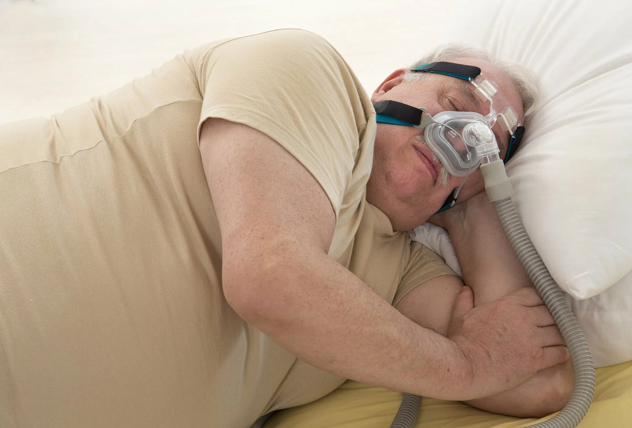 Заболевание апноэ во сне. Синдром апноэ во сне. Синдром обструктивного апноэ сна.