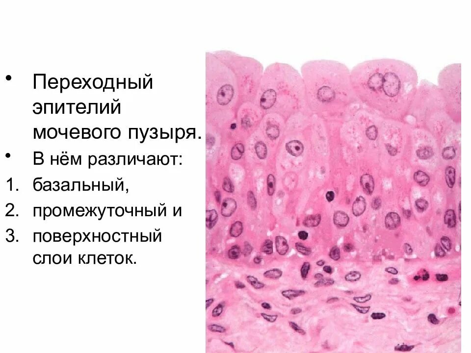 Плоский эпителий в цитограмме. Переходный эпителий уротелий. Эпителий мочевого пузыря гистология. Переходный эпителий мочевого пузыря гистология. Уротелий мочевого пузыря гистология.