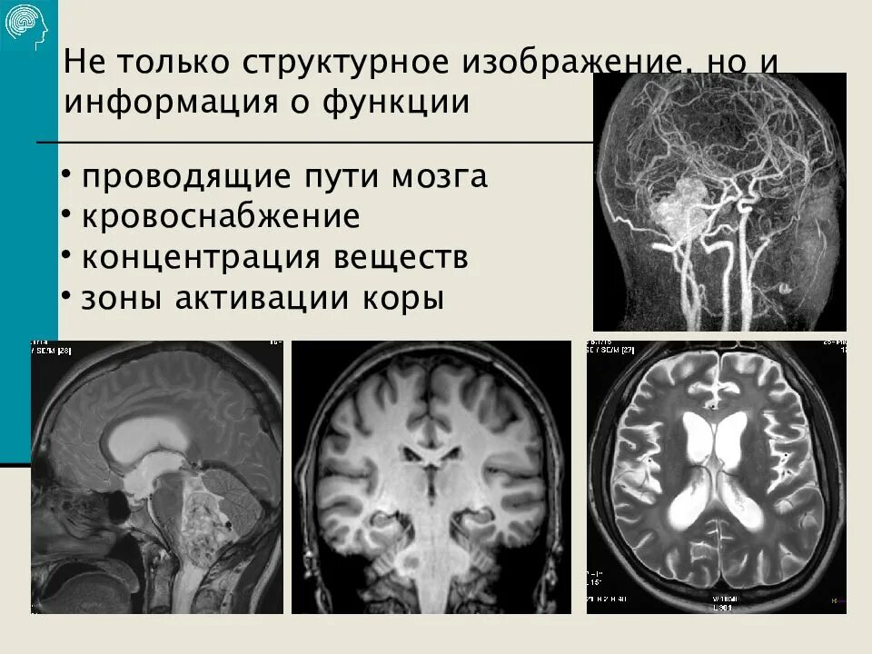 Институт мозга невролог. Институт головного мозга Бехтеревой сайт. ПЭТ Нейровизуализация. Институт мозга Санкт-Петербург. ПЭТ/кт Бехтерева институт мозга человека.