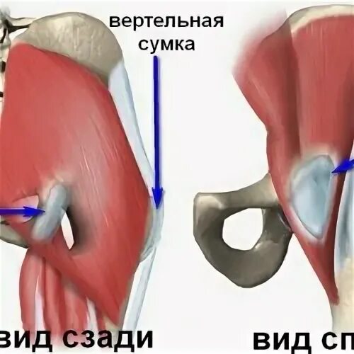 Трохантерит тазобедренного сустава признаки и лечение