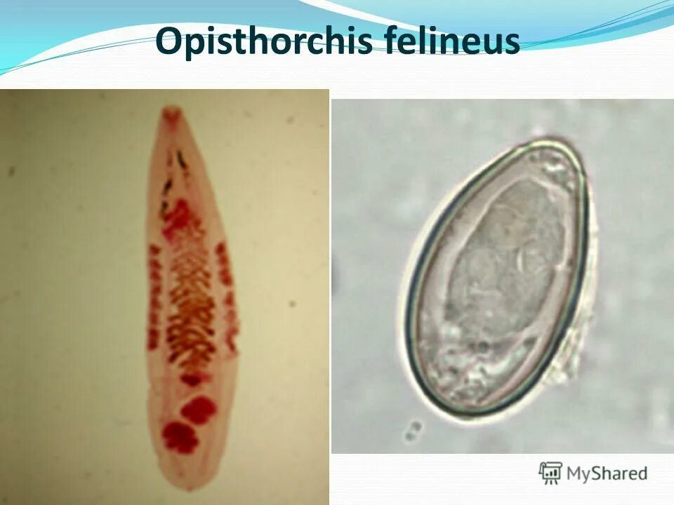 Кошачья двуустка аскарида. Кошачья двуустка аскарида. Сосальщик ланцетовидная двуустка. Трематоды кошачья двуустка. Кошачья (сибирская двуустка) описторх.