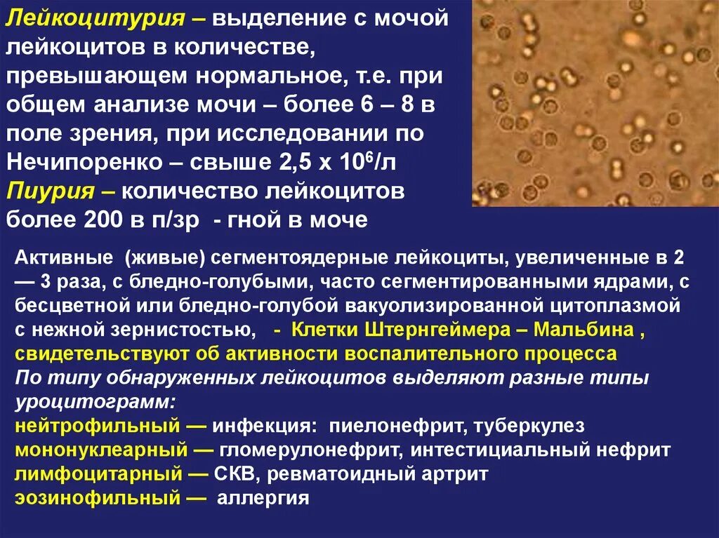 Что значит лейкоциты качественно в моче. Лейкоцитурия бактериурия. Завышенные лейкоциты в моче. Обнаружение лейкоцитов в моче. Появление лейкоцитов в моче.