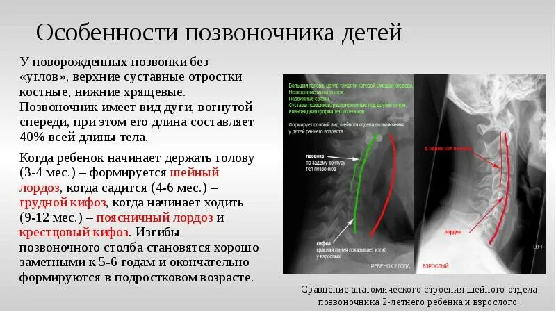 Аномалия развития позвоночника внутриутробно. Врожденный порок развития позвоночника. Врожденная аномалия развития позвоночника.