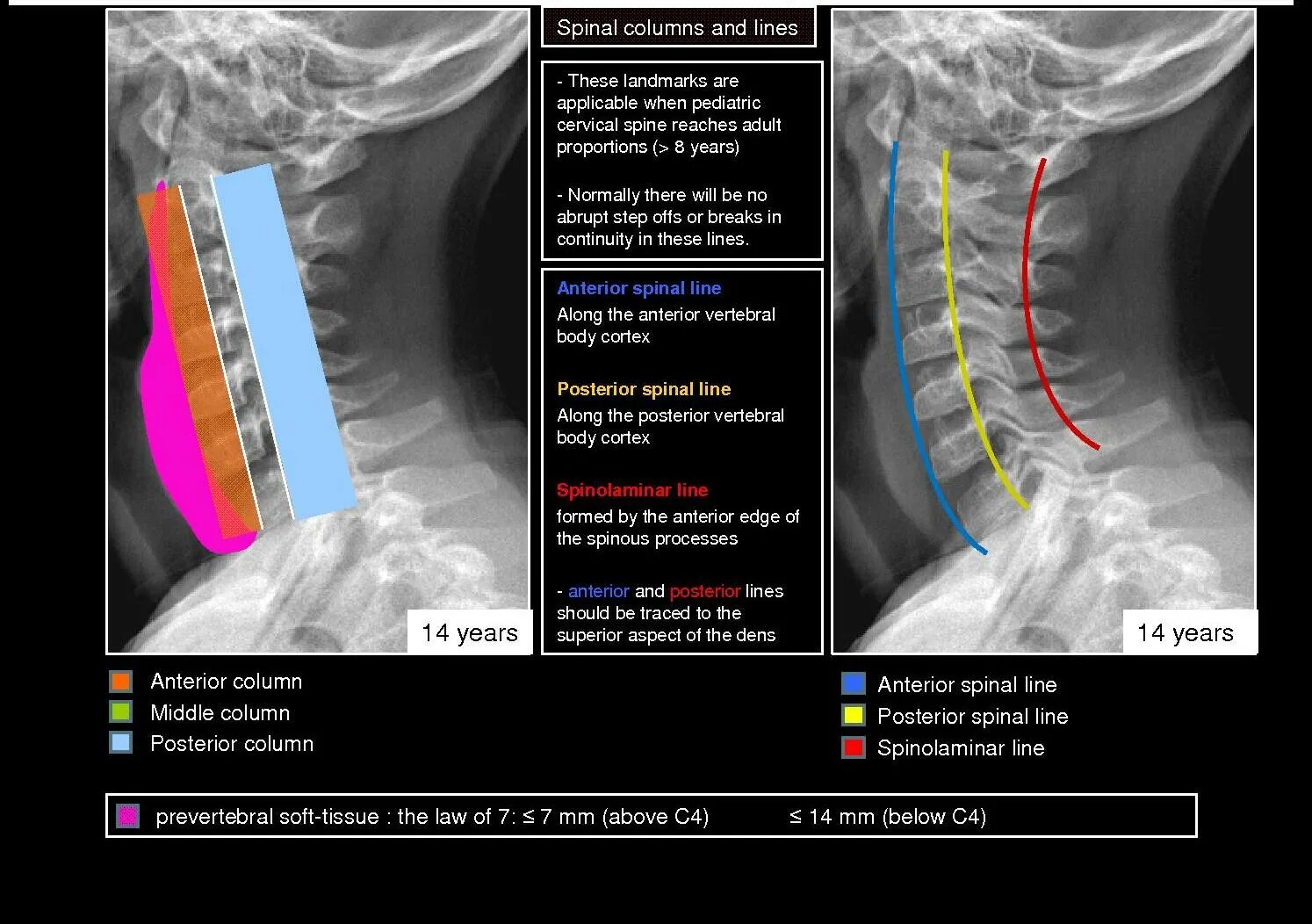 Spin columns. Spinal column плакат. Spine программа. Columns of Spine. Viper Spinal column.