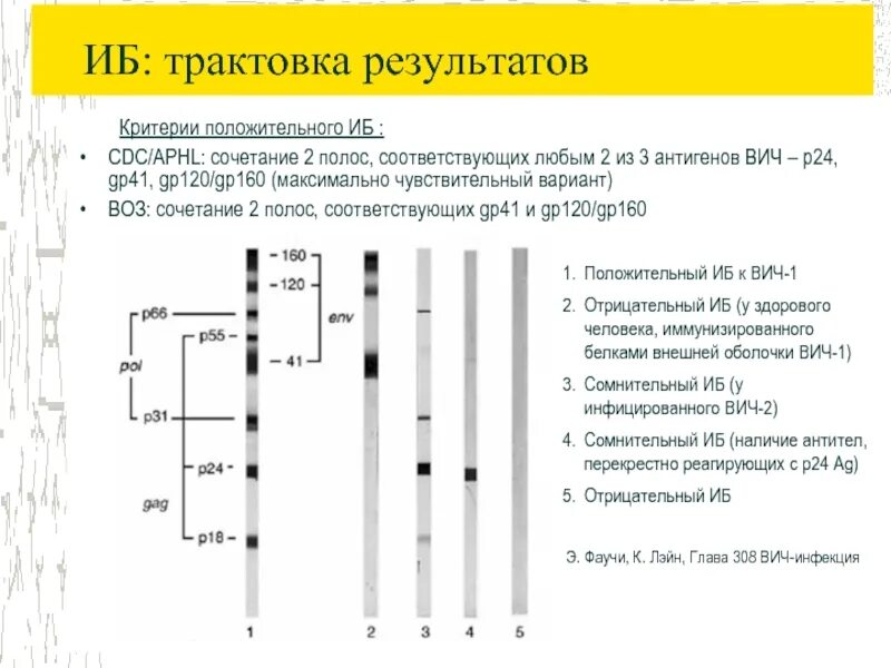 ИФА И иммуноблоттинг. Иммуноблоттинг для диагностики ВИЧ инфекции. Интерпретация результатов ИФА ВИЧ. Иммуноблот на ВИЧ анализ. Расшифровка иб