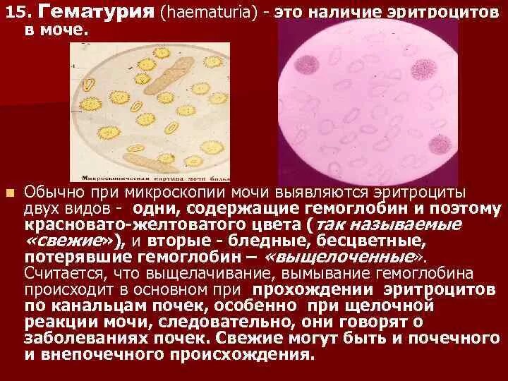 Сколько эритроцитов в моче