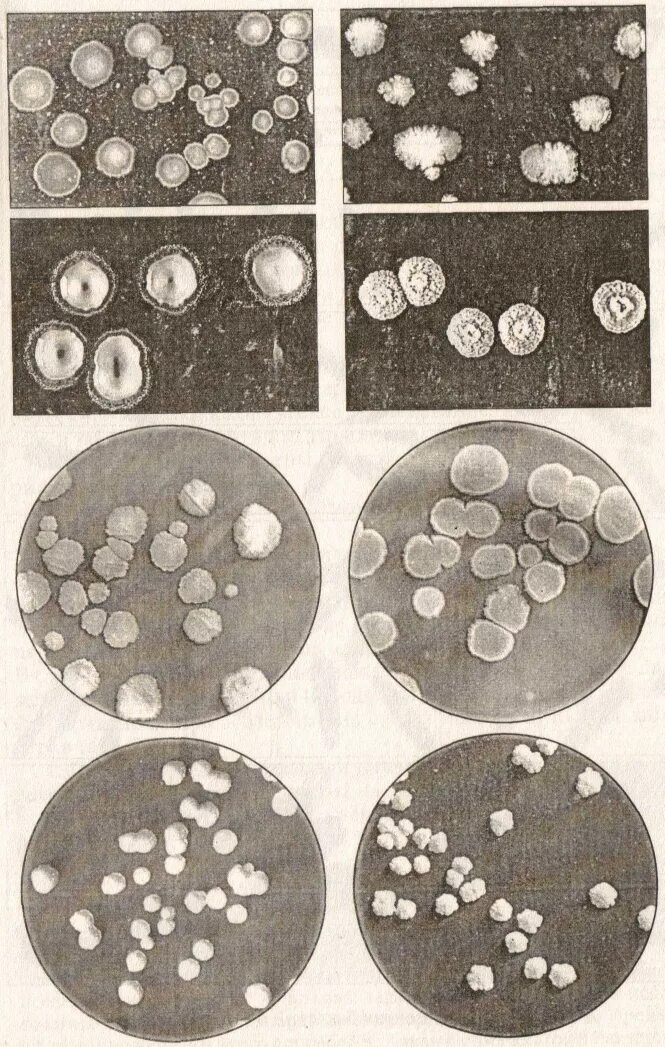 Актиномицеты бактерии колонии микроорганизмов. Гиалиновые колонии микроорганизмов. Колонии бактерий кокки. Колонии актиномицетов на агаре.