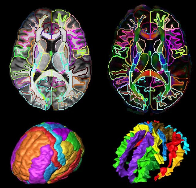 Brain find Зебра. Brain Imaging Tools. Brain imaging