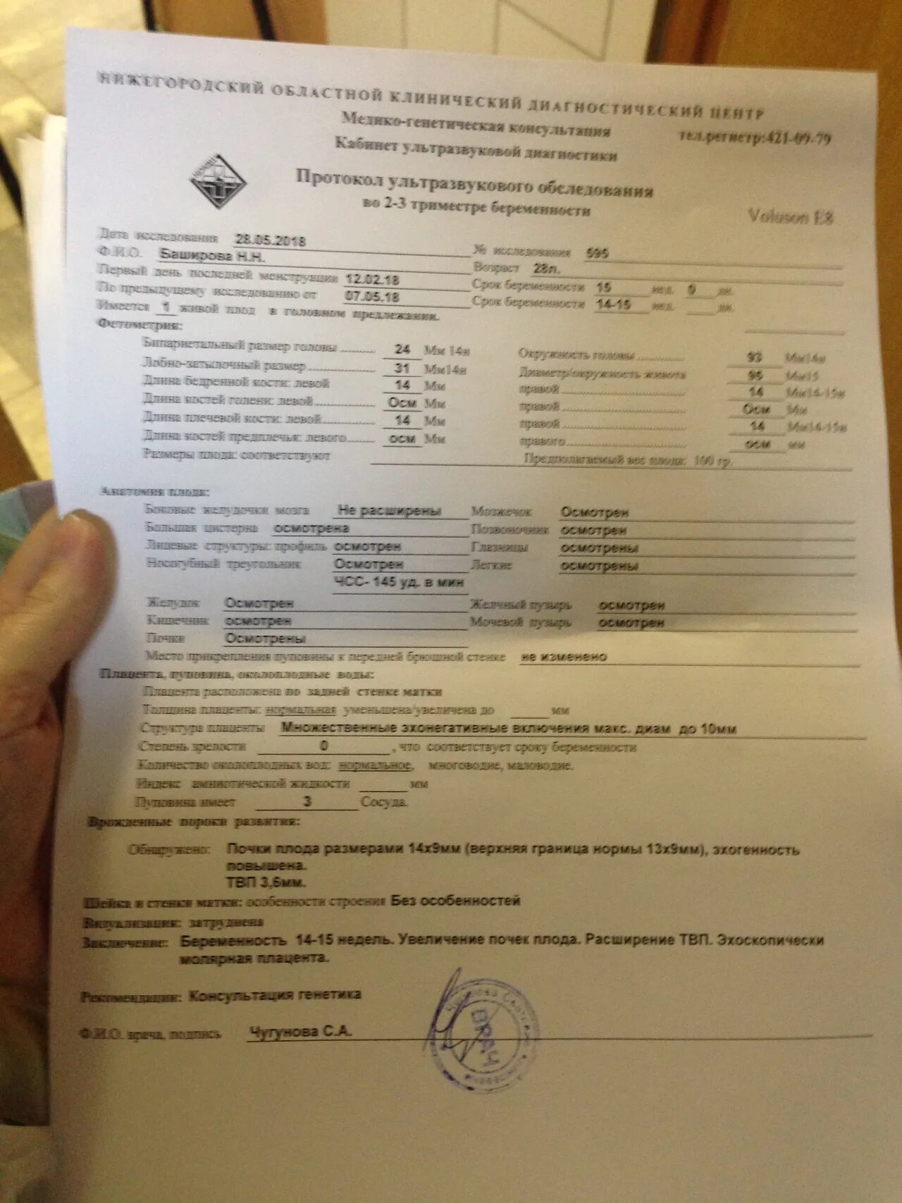 Толщина воротникового пространства 1 1. Скрининг твп. толщина воротникового пространства 1,4 мм. воротниковое пространство 1,4 мм. протокол узи 15 недель.