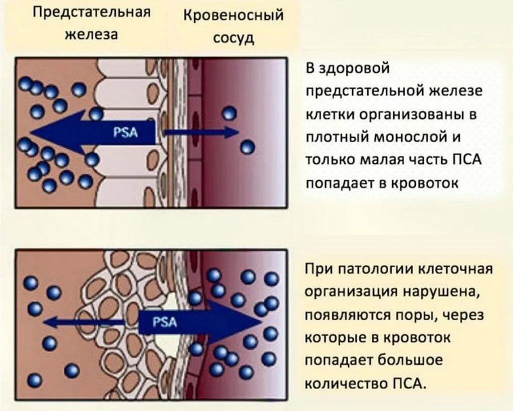 Норма пса у мужчин. Простатический специфический антиген. Простатический специфический антиген пса. Норма PSA В крови у мужчин. Исследование уровня простатспецифического антигена в крови.