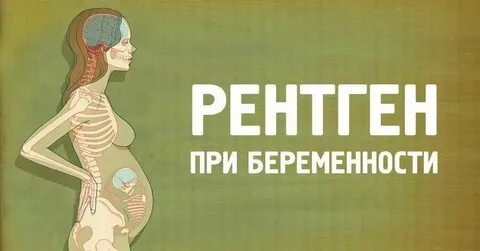 Флюорография на ранних сроках беременности до задержки