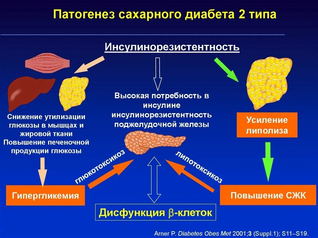 Патогенез СД 1 типа. Механизм СД 2 типа. Механизм развития СД 2. Этиология и патогенез сахарного диабета (СД 1-го типа и СД 2-го типа).