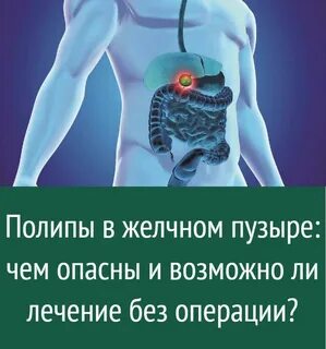 Полипы в желчном как лечить у женщин