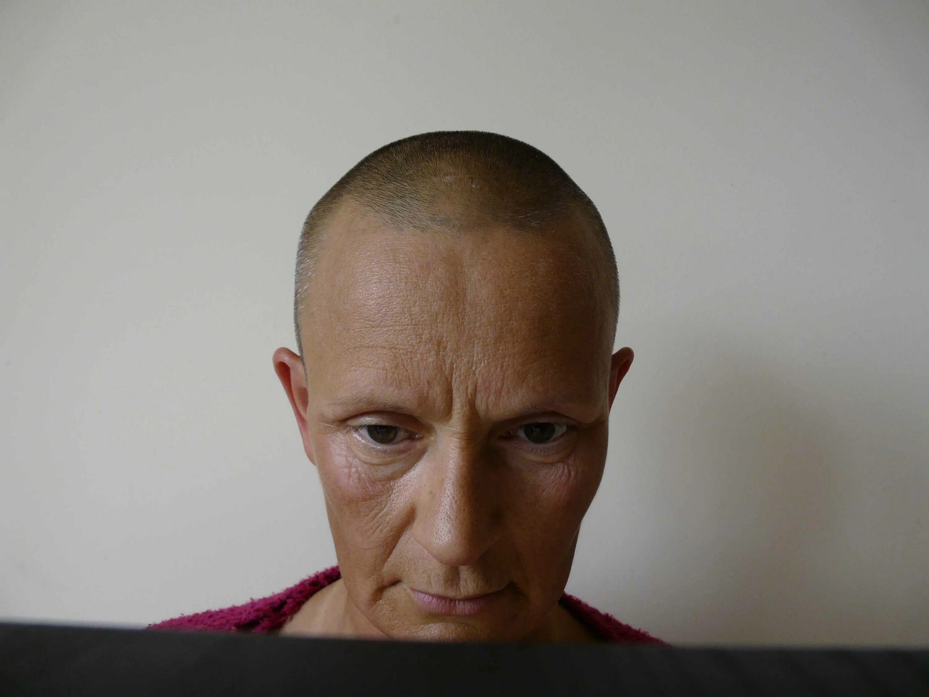 Принц гарри лысина. Примерить лысину. Примерить лысину. Зачес лысины сзади вперед. Сверкающая лысина.