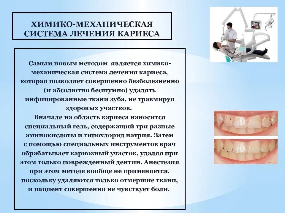 Проведение профилактики кариеса. Методы профилактики кариеса. профилактика кариеса презентация. кариес и его профилактика.