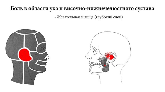 Болит голова лоб. Головная боль во лбу. Схема локализации головной боли. Боли в правой височной области