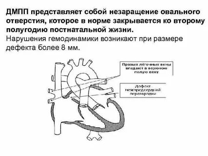 Размер дмпп
