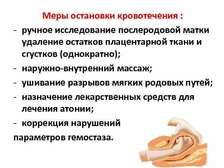 Остановка послеродового кровотечения алгоритм. Остановка кровотечения в 3 периоде родов. Методы остановки маточного кровотечения. Методы остановки раннего послеродового кровотечения. Почему после акта кровит