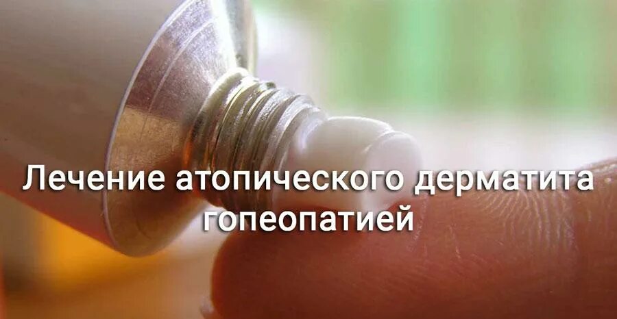 Атопический дерматит психосоматика у младенцев. Гомеопатия при атопии. Крем гомеопатический при атопии. Атопический дерматит гомеопатия. Атопический дерматит гомеопатия.