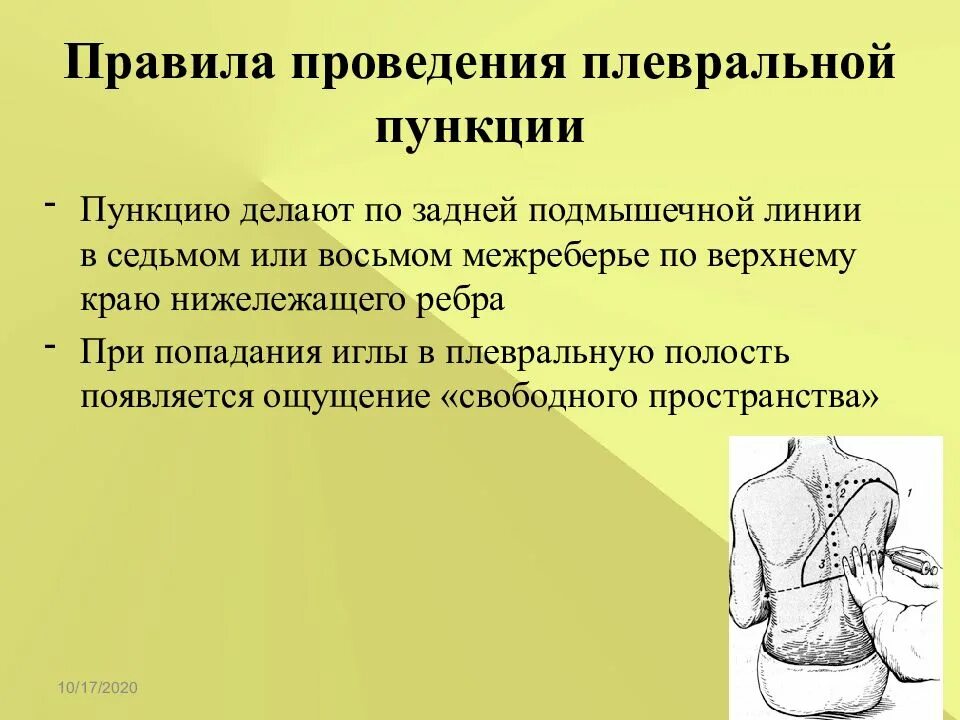 Техника выполнения плевральной пункции. Плевральная пункция техника. Показания к проведению плевральной пункции. Показания к пункции плевральной полости.