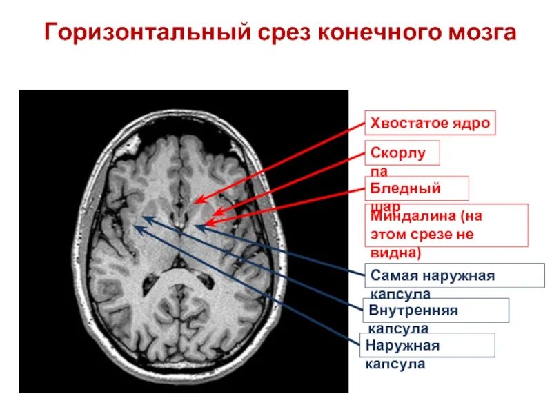 Хвостатое ядро мозга. Наружная капсула анатомия. Скорлупа головной мозг кт. Горизонтальный срез конечного мозга.