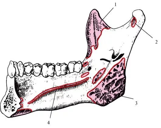 жевательные мышцы височные мышцы таблица. мышцы участвующие в движении нижней челюсти. места прикрепления мышц на нижней челюсти. мышцы подвисочной ямки. жевательные мышцы лица анатомия сбоку.