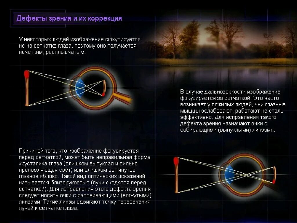 По распространенной точке зрения чтение. Дефекты зрения физика. Дефекты зрения с точки зрения физики. Дефекты зрения и их коррекция. Недостатки зрения физика.