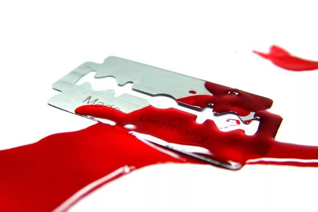 Как грамотно вскрыть вены. Как правильнототкрывать шампанское. Как правильно вскрыть. Как открыть шампанское. Как грамотно вскрыть вены.