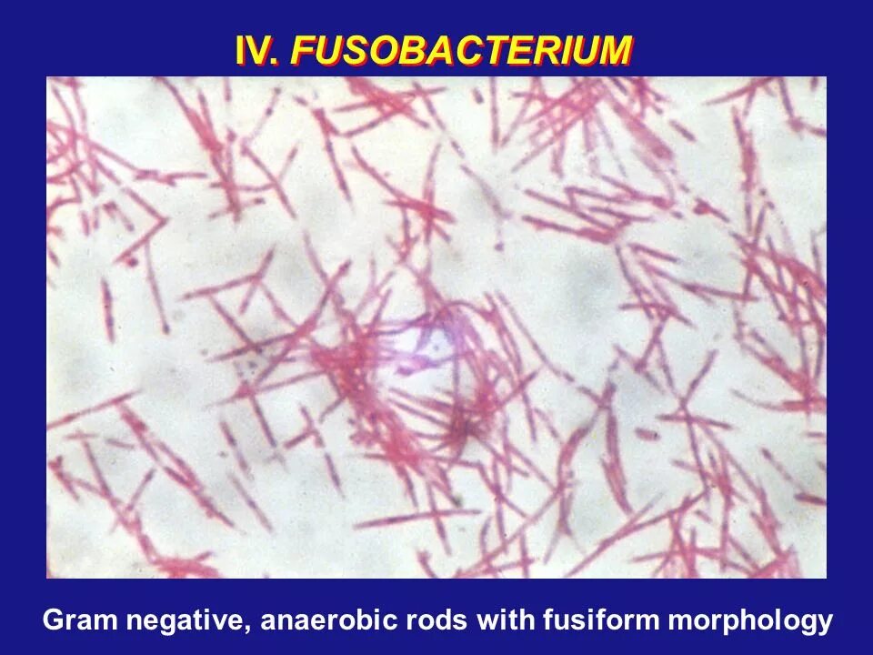 Fusobacterium spp. Fusobacterium spp микроскопия. фузобактерии морфология. фузобактерии микробиология. фузобактерии и спирохеты.