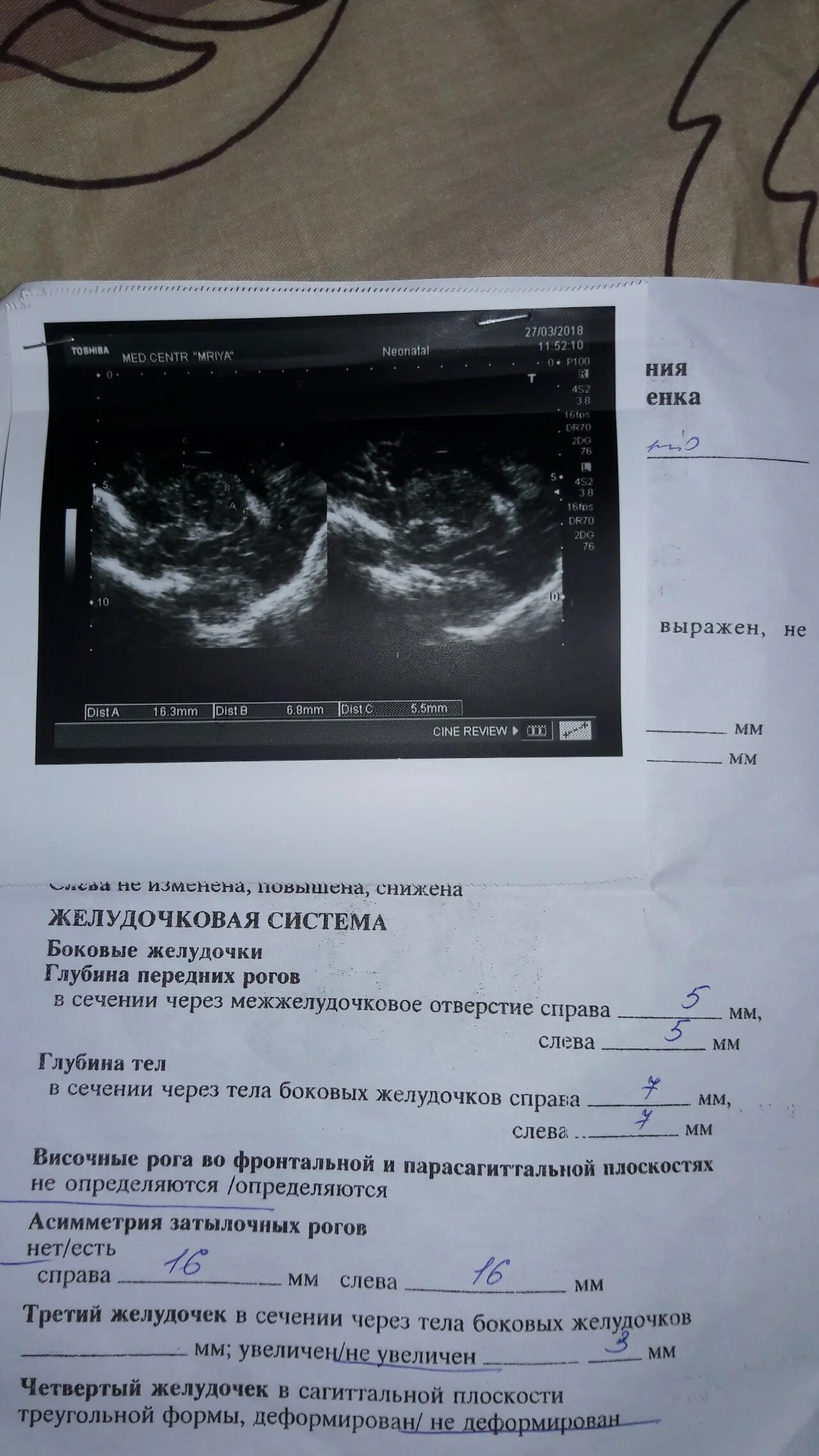 Узи мозга норма. УЗИ головы в три месяца. Протокол УЗИ головы новорожденного ребенка.