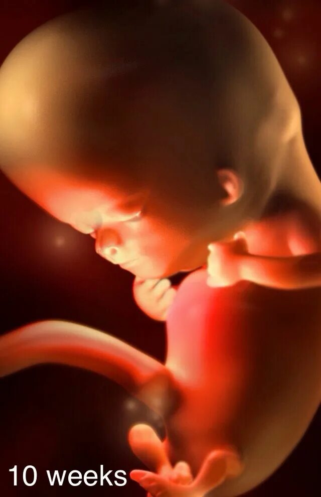 Ten weeks Pregnancy, Parenting, Prego