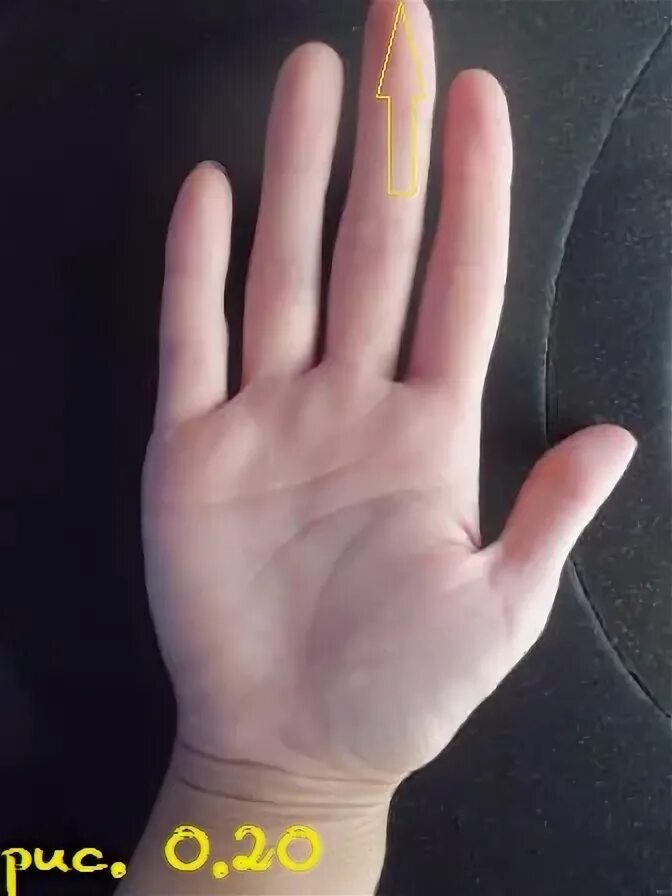 Арахнодактилия паучьи пальцы. Исправление формы ногтей. Арахнодактилия паучьи пальцы. Удлинение пальцев. Эмоции и пальцы рук.