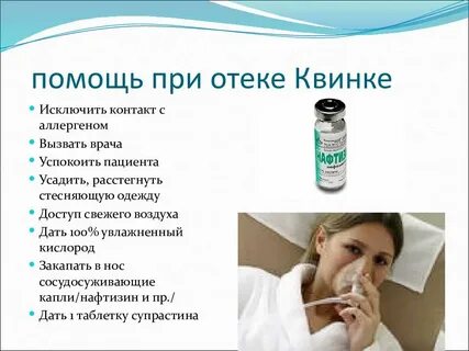 Отек квинке код