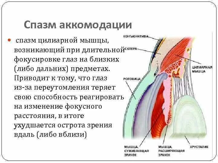 Мышцы аккомодации. Спазм аккомодации мышцы. Иннервация аккомодационной мышцы глаза. Аккомодация цилиарная мышца. Аккомодация спазм аккомодации.