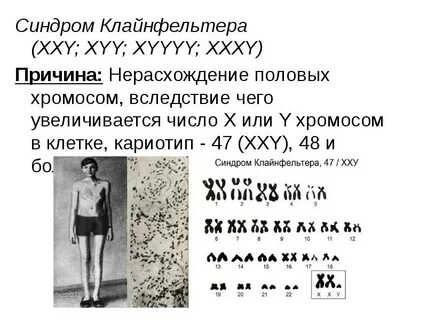 Кариотип хху