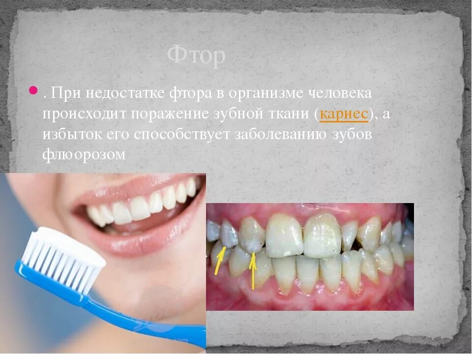 При недостатке фтора в организме развивается ответ. Влияние фтора на зубную эмаль. Реминерализация эмали зубов. Фтор воздействие на зубы.