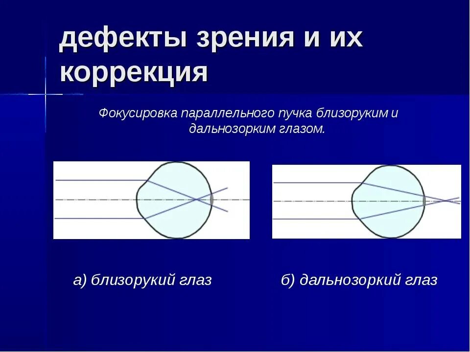 Глаз и зрение физика 9. Коррекция дефектов зрения физика. Дефекты зрения и их исправление. Оптические дефекты глаза. Дефекты зрения близорукость и дальнозоркость.