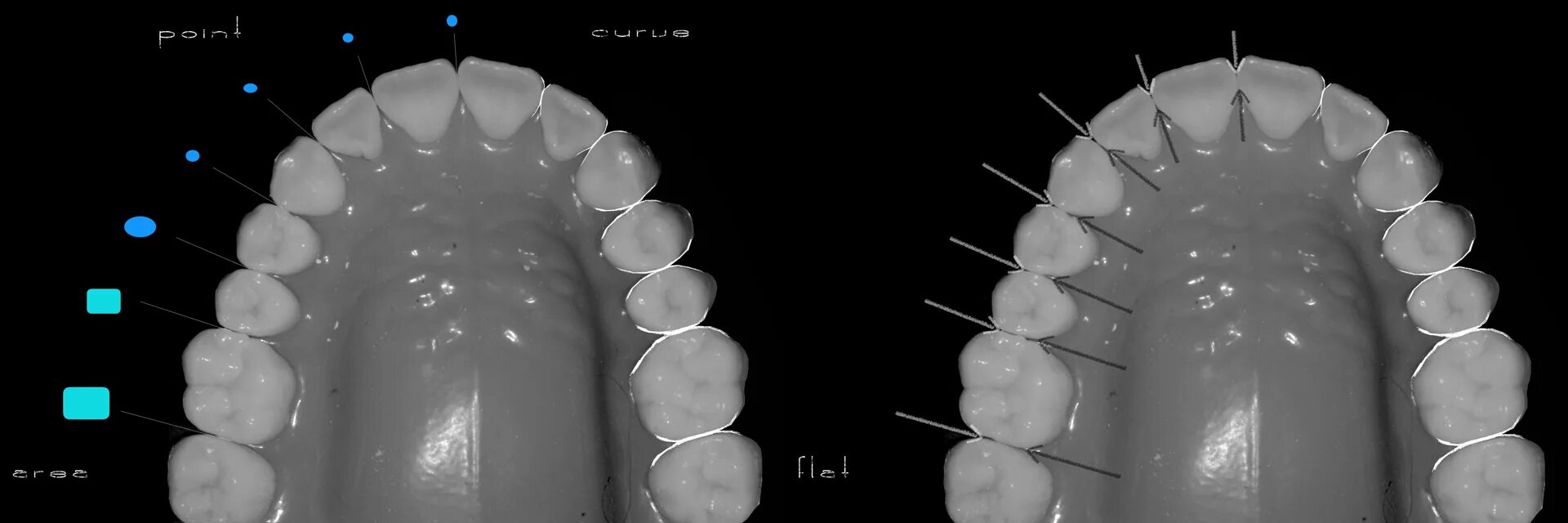 Плотный отсутствие. Контактные пункты зубов. Восстановление контактного пункта зуба. Расположение контактного пункта у зубов.
