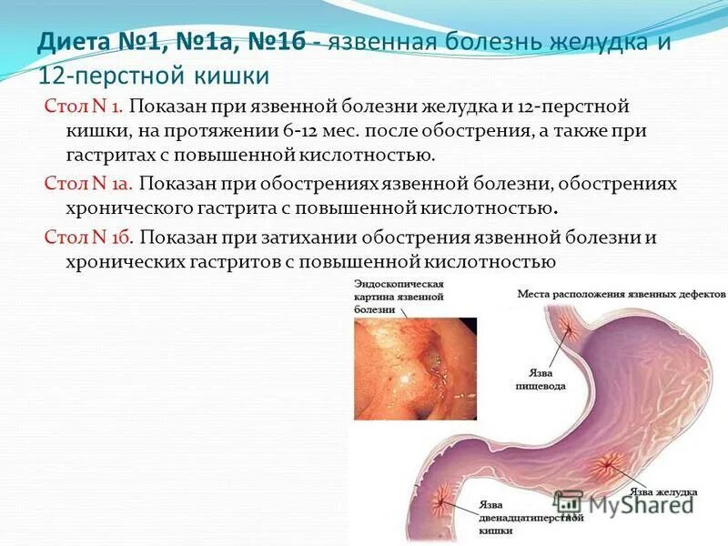 Жалобы при язвенной болезни 12 перстной кишки. Полип 12 перстной кишки симптомы. Гормоны 12 перстной кишки. Мкб язва 12 перстной кишки