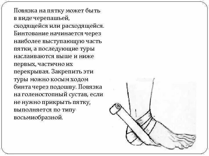 Какая повязка накладывается при повреждении голеностопного сустава. Повязка на область пятки техника наложения. Повязка на пяточную область алгоритм. Повязка на пяточную область (по типу черепашьей). Бинтовая повязка на пяточную область.