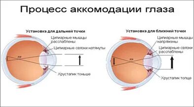 Какая структура обеспечивает аккомодацию. Спазм аккомодации. Аккомодация это в офтальмологии. Адаптация и аккомодация глаза. Нарушение аккомодации.