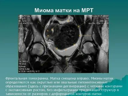 Центр миом