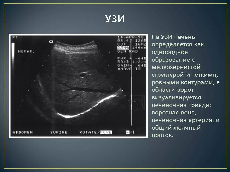 Узи печени собаки. Эхограмма печени.