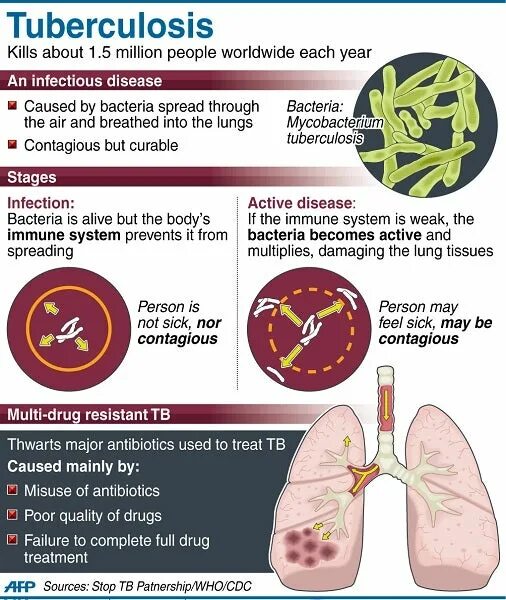 Новый туберкулез в великобритании. Tuberculosis плакат. Prevention of tuberculosis. Tuberculosis of the years.