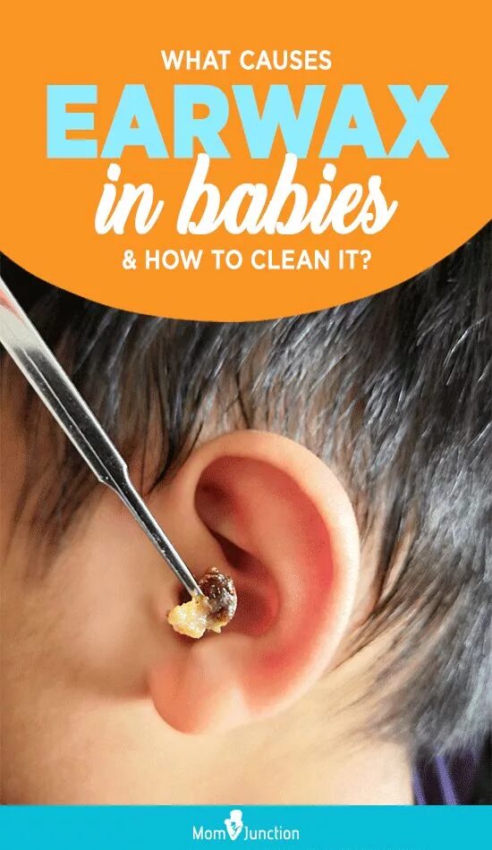 Ear wax. Ушной очиститель. Серная пробка ватные палочки. Серная пробка ватные палочки. Ear wax.