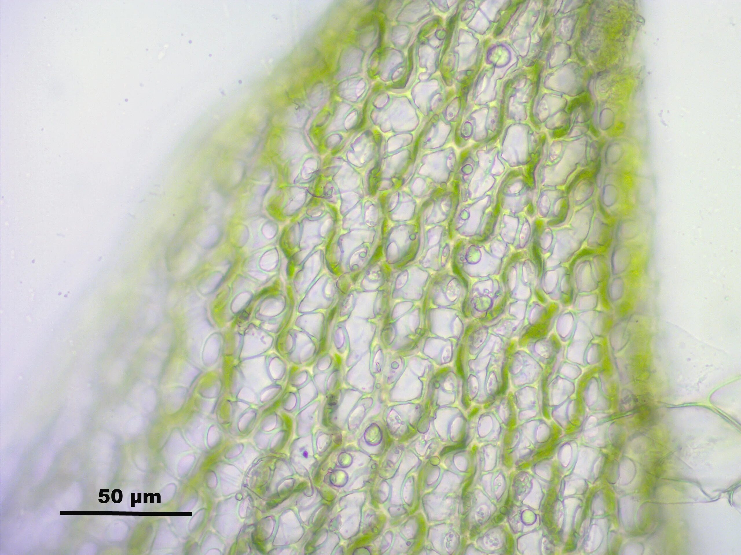 Водоносные клетки в листьях имеет. Хлорофиллоносные клетки сфагнума. Водоносные клетки сфагнума. Клетки листа сфагнума под микроскопом. Sphagnum fimbriatum.