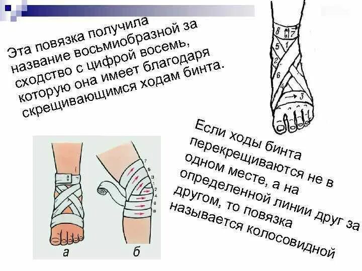 Восьмиобразная повязка техника. Крестообразная восьмиобразная повязка на стопу алгоритм. Восьмиобразная повязка техника наложения. Технология наложения повязки восьмиобразная.