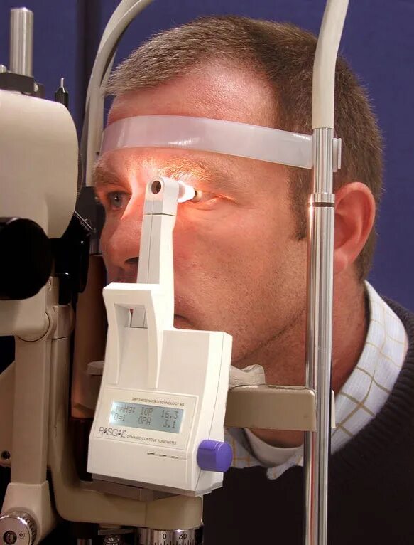 Тонометрия ВГД. Тонометрия (измерение глазного давления). Транспальпебральная тонометрия. Тонометр тонограф офтальмологический. Прибор глазного давления