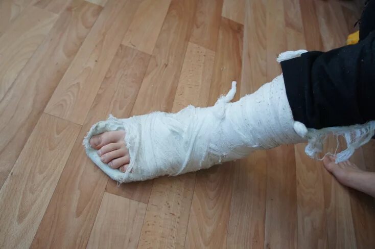 можно ли снимать гипс на ночь